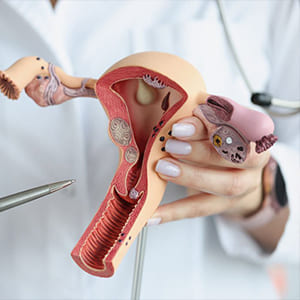 cirugia-ginecologica